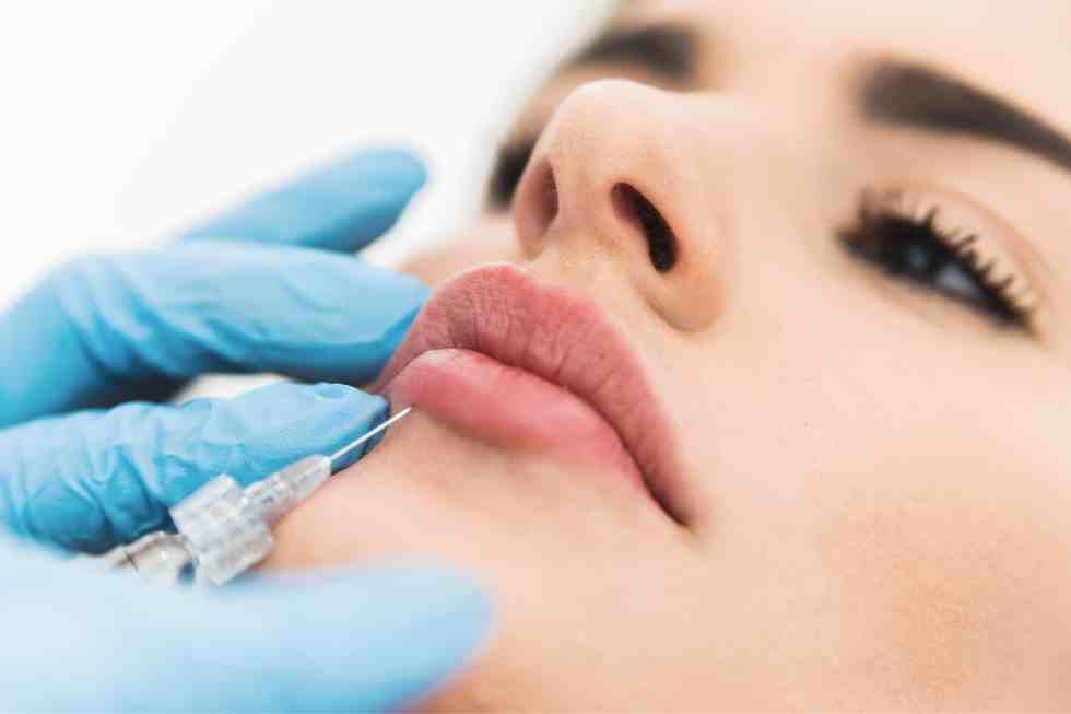 Juvederm Labios: Opiniones y Guía Completa