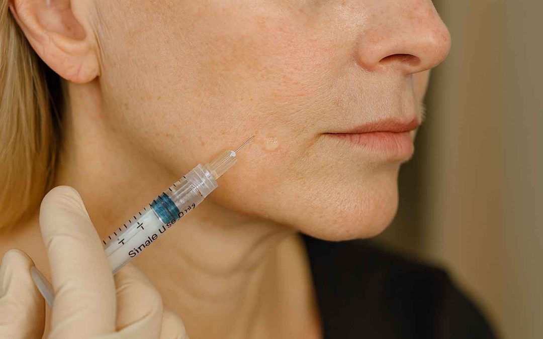 Intradermal microdroplet injection plane diagram for Juvederm Skinvive, showing epidermis, dermis, and subcutaneous tissue layers.